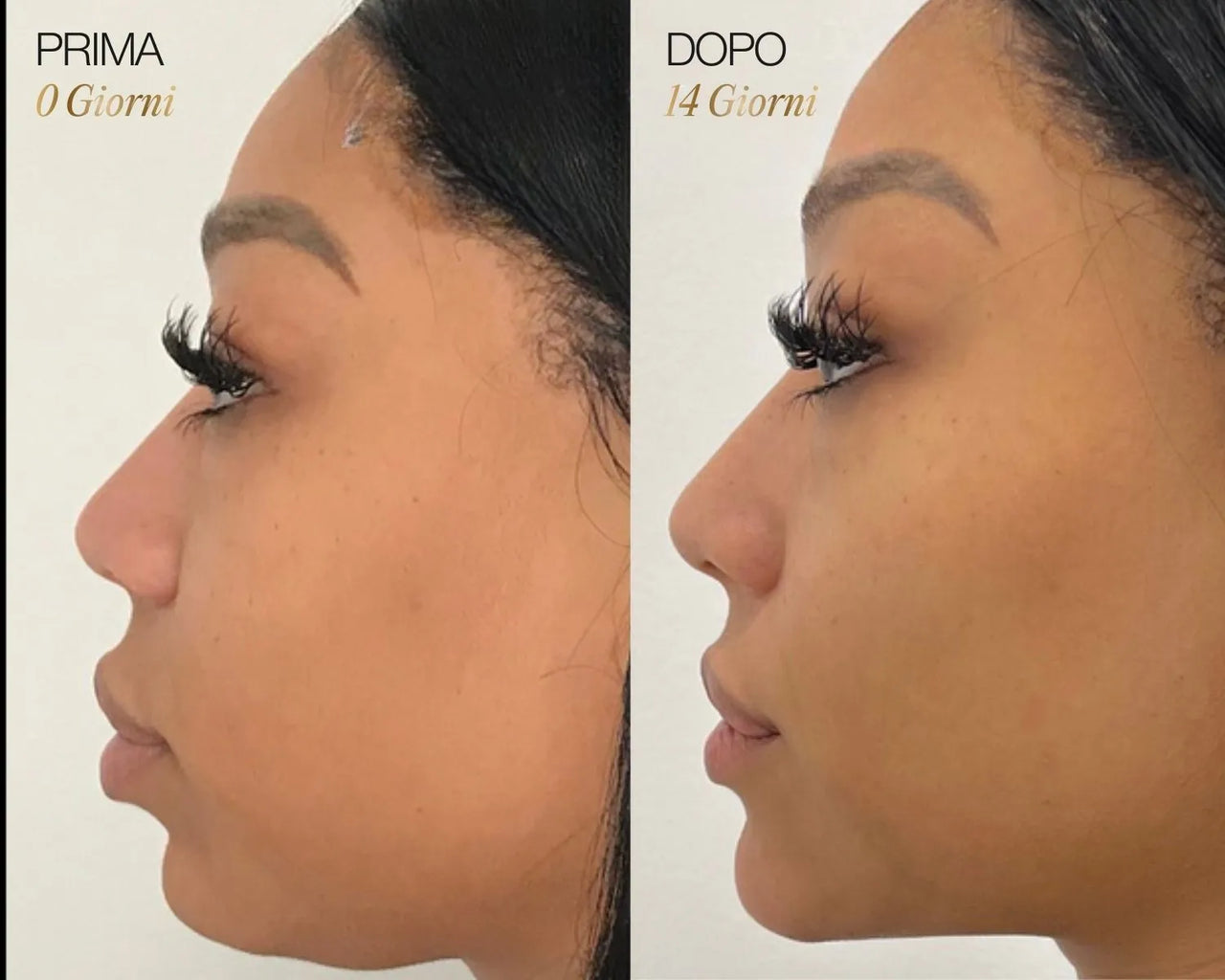 Lymphatic Face Brush