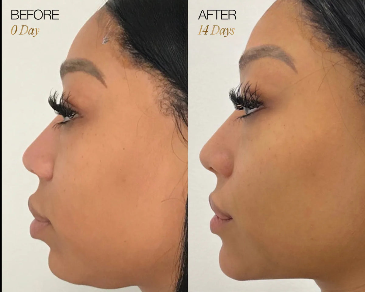 Lymphatic Face Brush